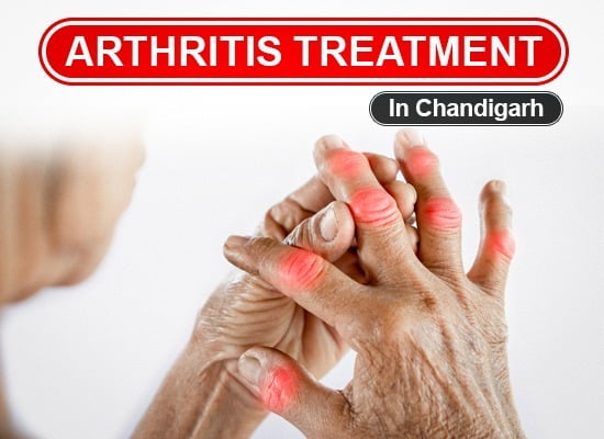 Arthritis Treatment in Chandigarh